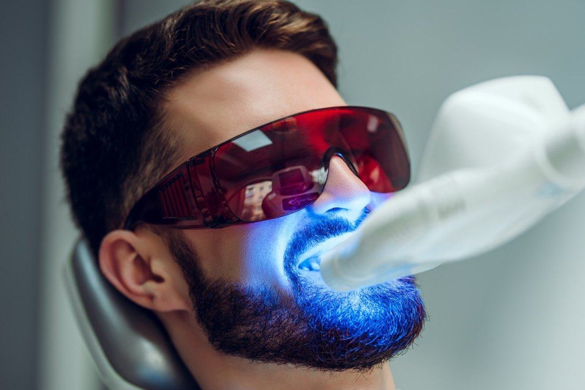An illustrative photograph of professional teeth whitening
